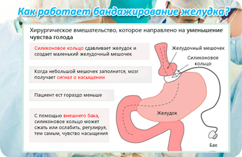 Хирургическое вмешательство